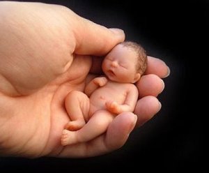 aborto-feto[1]